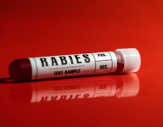 Rabies virus blood test sample tube close-up white label, red background